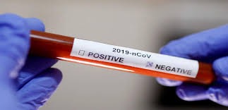 بلدية مغدوشة: نتائج فحوص الـ PCR في احد المجمعات سلبية
